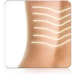 Magnetotherapy